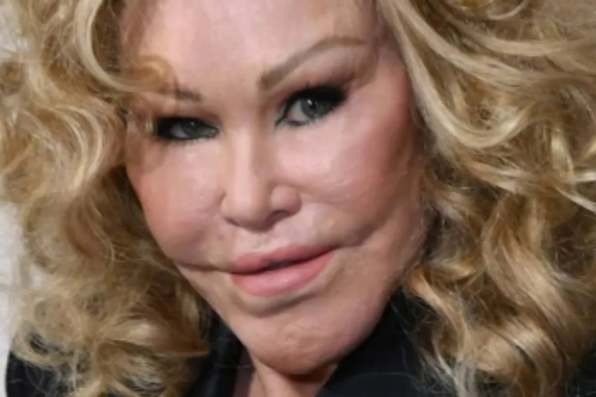 Muere Jocelyn Wildenstein, la millonaria 'Catwoman' que se operó para parecerse a un felino Muere Jocelyn Wildenstein, la millonaria 'Catwoman' que se operó para parecerse a un felino
