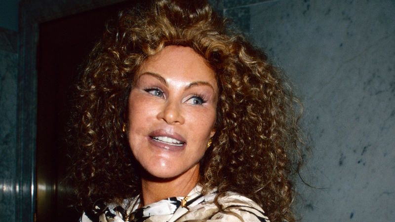 Muere Jocelyn Wildenstein, conocida como la “mujer gato” por sus cirugías estéticas extremas Muere Jocelyn Wildenstein, conocida como la “mujer gato” por sus cirugías estéticas extremas